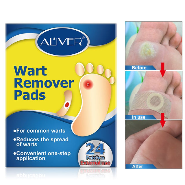 Aliver Wart Remover Strips for Foot Care Cleaning anti Pruritus and Antibacterial 24 Pcs