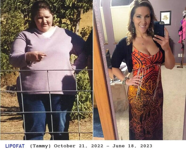 Lipo 1000 Mg Fat Burner, Weight Loss Pills, Shrink Belly Fat, for Men & Women - 30 Capsules