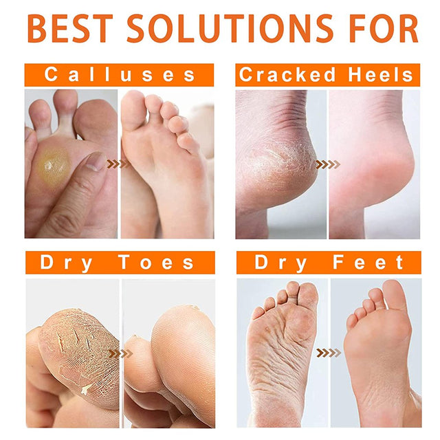 Aliver Foot Peel Mask 2 Pairs Peach Baby Soft Foot