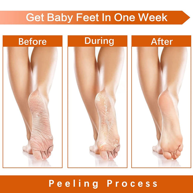 Aliver Foot Peel Mask 2 Pairs Peach Baby Soft Foot