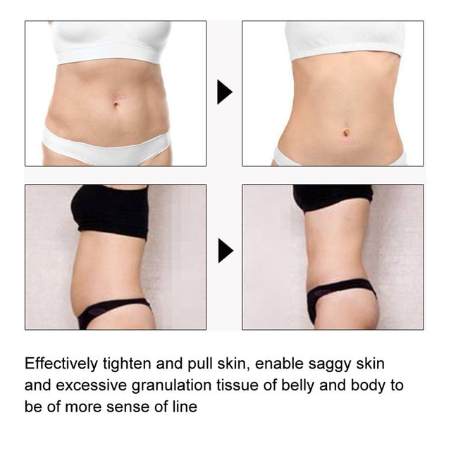 10Ml Slimming Cellulite Body Care Weight Loss Fat Burn Massage Essential Oil