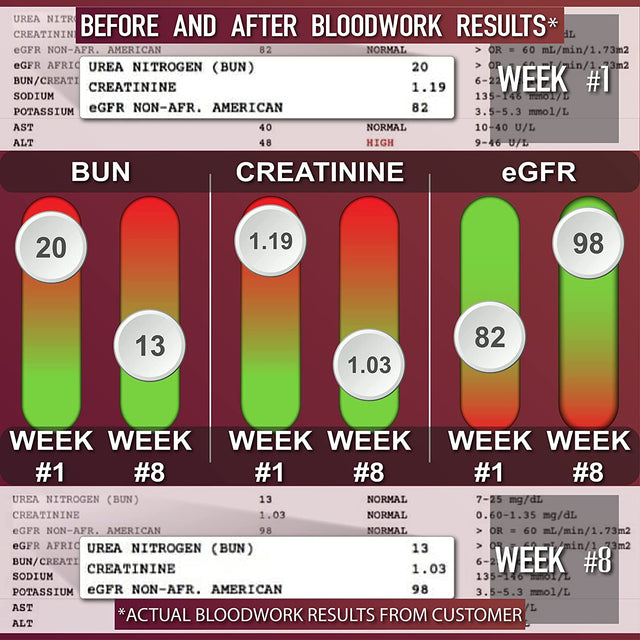 Leviathan Super Kidney Cleanse & Urinary Detox Formula | Optimal Kidney Health & Gallbladder Formula | Full Restore & Detox - Manage Kidney Stones | 120 Caps