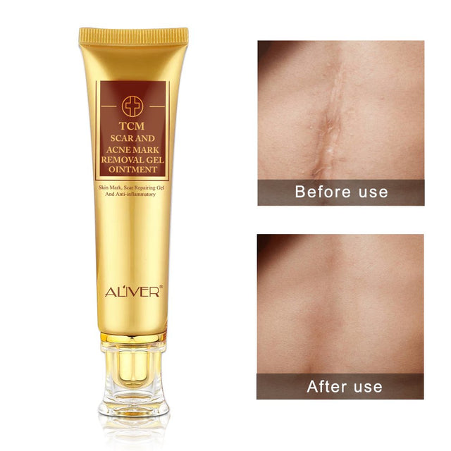 Aliver 2 Pack TCM Scar Acne Mark Removal Gel Anti-Inflammatory