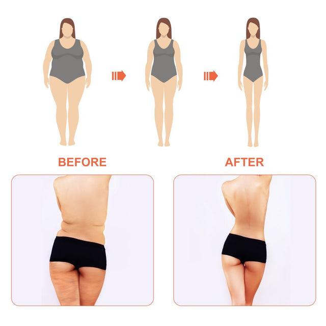 Gecheer 30Pcs Slim Patch Navel Sticker -Obesity Fat Burning for Losing Weight Abdomen Slimming Patch Paste Belly Waist