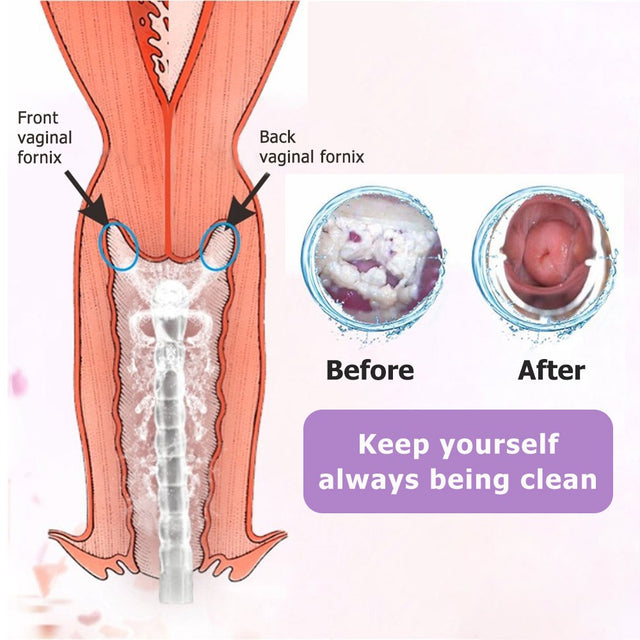 Hailicare Enema Kit - 300Ml Anal or Vaginal Douche Cleaner Kit for Men or Women with 2 Nozzle Tips - Easy to Use and Comfortable Cleaner