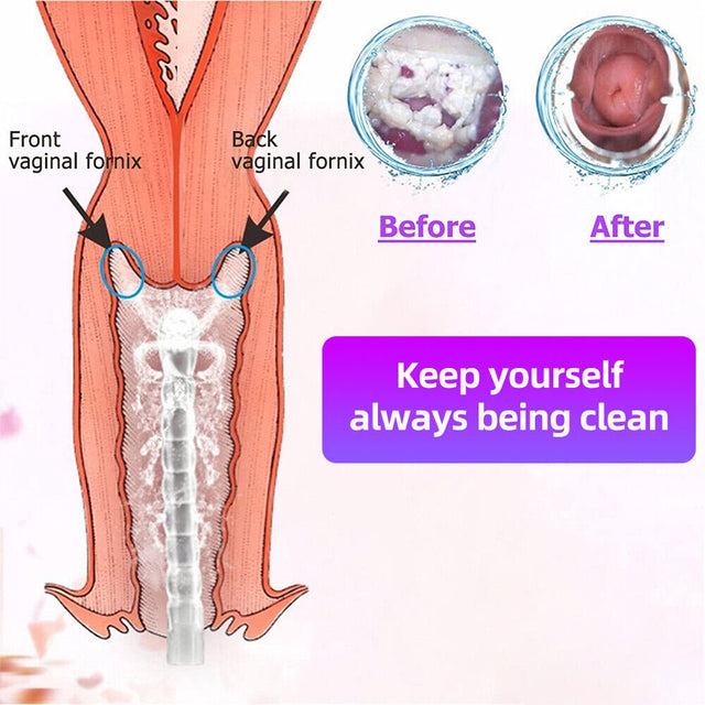 Kingfurt Silicone Vaginal Irrigator - Reusable Pudendal Syringe for Gynecological Health - Non-Allergenic & BPA Free - 9-Hole Spray Design