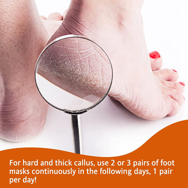 Aliver Foot Peel Mask 2 Pairs Peach Baby Soft Foot