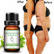 10Ml Body Slimming & Firming Essential Oil Fat Burning Potent Effect Lose Weight Chemical Free Cellulite Oil Massage Treatment for Firming Stomach, Legs, and Arms