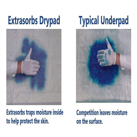 Medline ULTRSORB3136 31 In. X 36 In. Ultrasorbs AP Underpads - White (10/Pack)