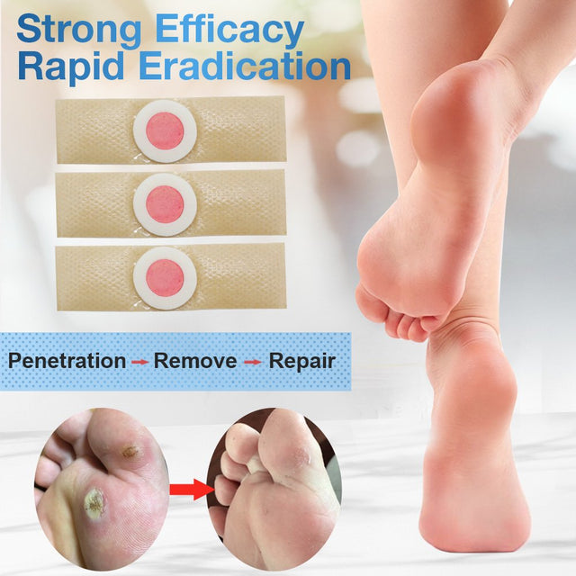 Aliver Wart Remover Strips for Foot Care Cleaning anti Pruritus and Antibacterial 24 Pcs