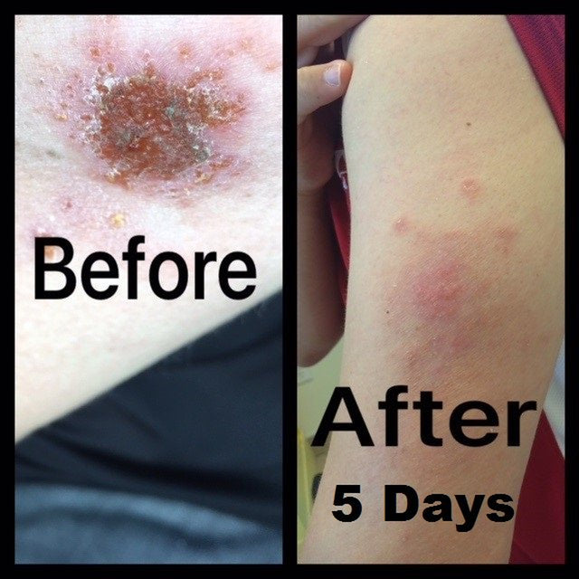 Fembiotics - Natural Probiotic Body Care for Women, Topical Spray, 4 Oz.