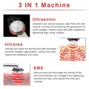 body-slimming-massager-3-in-1-ultrasonic-rf-machine-skin-care-weight-burning-massager-with-300ml-gel-for-belly-arm-and-leg-02-11e36506b4684aec4b07eed7de47af78.jpg