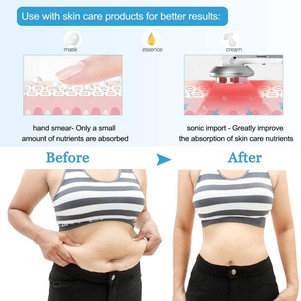 body-slimming-massager-3-in-1-ultrasonic-rf-machine-skin-care-weight-burning-massager-with-300ml-gel-for-belly-arm-and-leg-03-b3ec51140788cb228a3dfd8feb92c2e5.jpg