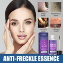 walmeck-30mlbottle-skin-remover-wart-removing-liquid-stinger-wart-remove-neck-facial-skin-excrescence-axillary-acuminate-liquid-03-7f467422488e748b9a4dd979a1a00a48_ba369005-4aa2-4826-84c2-d7cfc95c34ac.jpg