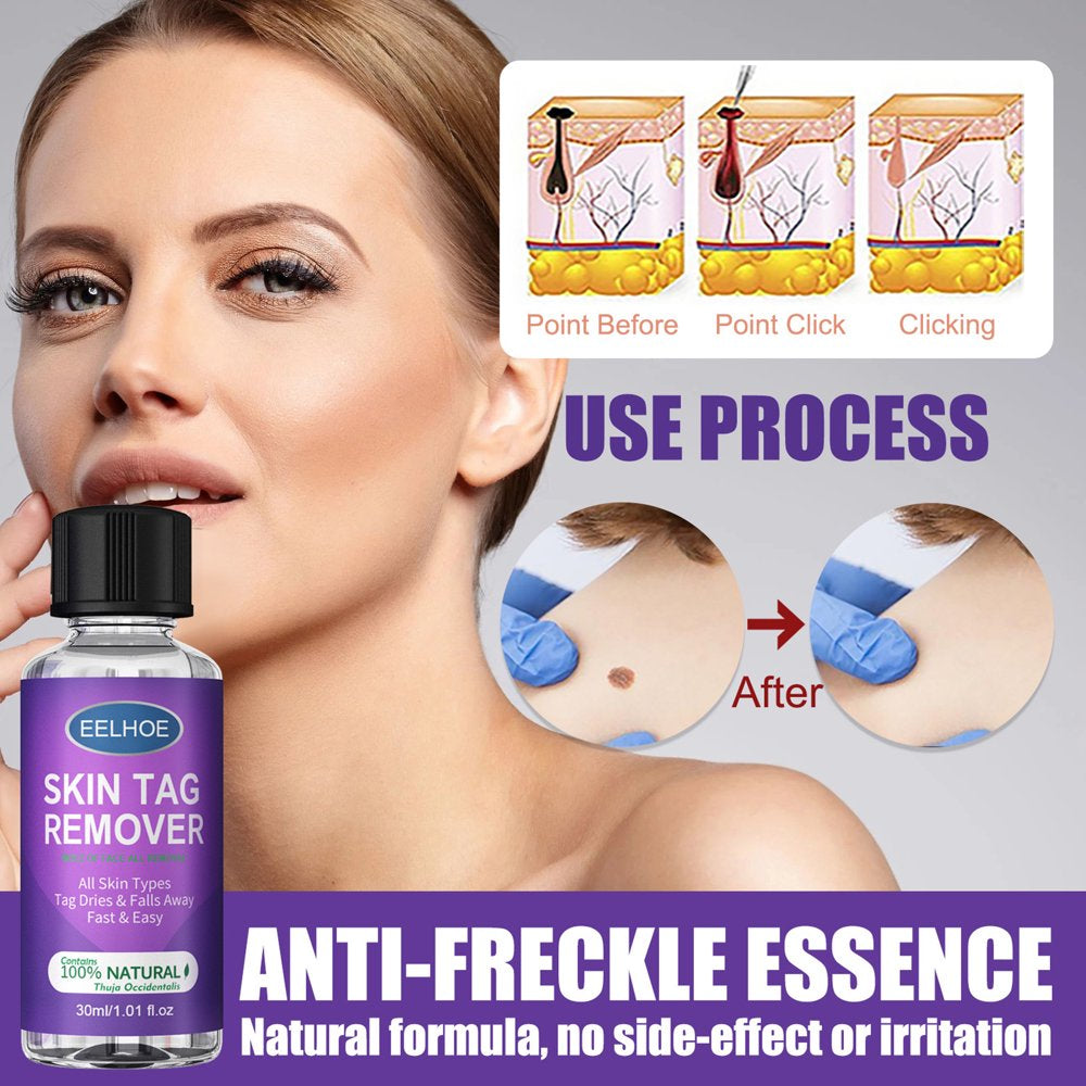 walmeck-30mlbottle-skin-remover-wart-removing-liquid-stinger-wart-remove-neck-facial-skin-excrescence-axillary-acuminate-liquid-07-1e827ee829cf5487e43de06896689cde_1048f654-4a56-401f-a3b6-73a558f65043.jpg