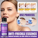 walmeck-30mlbottle-skin-remover-wart-removing-liquid-stinger-wart-remove-neck-facial-skin-excrescence-axillary-acuminate-liquid-07-1e827ee829cf5487e43de06896689cde_1048f654-4a56-401f-a3b6-73a558f65043.jpg